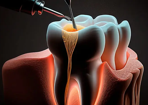 Endodontia